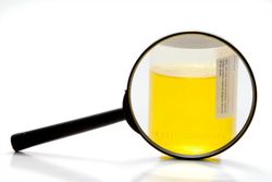 Magnifying glass sitting in front of a urine sample.